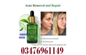 Breylee Acne Treatment Serum Price In Pakistan / 03476961149