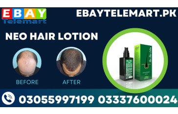 Green Wealth Neo Hair Lotion Price In Lahore | 03337600024