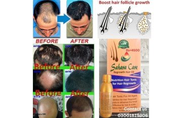 Sahara Care Regrowth Hair Oil in Pakistan - 03001819306