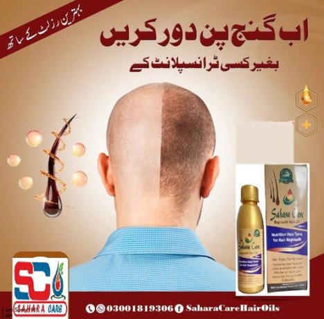 sahara-care-regrowth-hair-oil-in-rawalpindi-923001819306-big-0