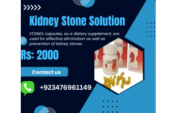 Stonex capsule price in Pakistan +923476961149