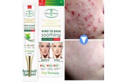 acne-freckle-cream-in-pakistan-ship-mart-face-acne-cleaning-cream-03000479274-small-0