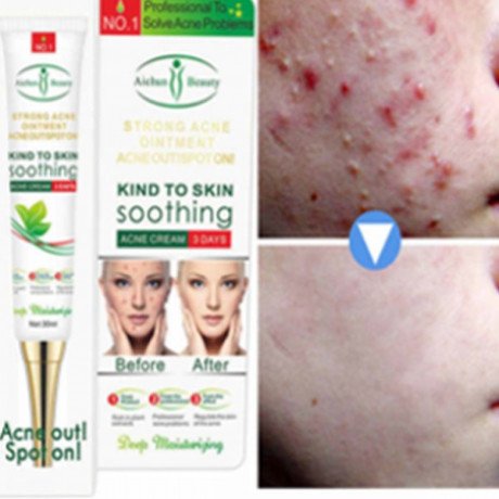 acne-freckle-cream-in-pakistan-ship-mart-face-acne-cleaning-cream-03000479274-big-0