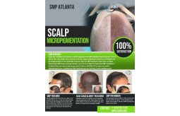 regain-your-lost-hairline-and-confidence-with-scalp-micropigmentationsmp-in-atlanta-small-1