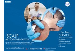 regain-your-lost-hairline-and-confidence-with-scalp-micropigmentationsmp-in-atlanta-small-2