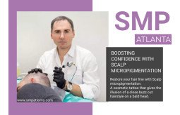 regain-your-lost-hairline-and-confidence-with-scalp-micropigmentationsmp-in-atlanta-small-0