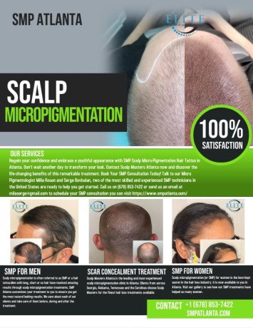 regain-your-lost-hairline-and-confidence-with-scalp-micropigmentationsmp-in-atlanta-big-1