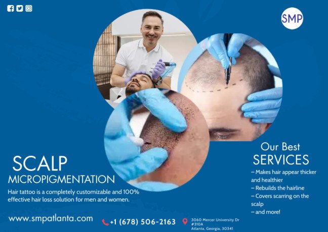regain-your-lost-hairline-and-confidence-with-scalp-micropigmentationsmp-in-atlanta-big-2