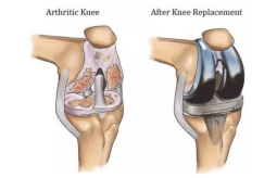 find-expert-knee-replacement-surgeon-in-delhi-delhi-ortho-clinic-small-0