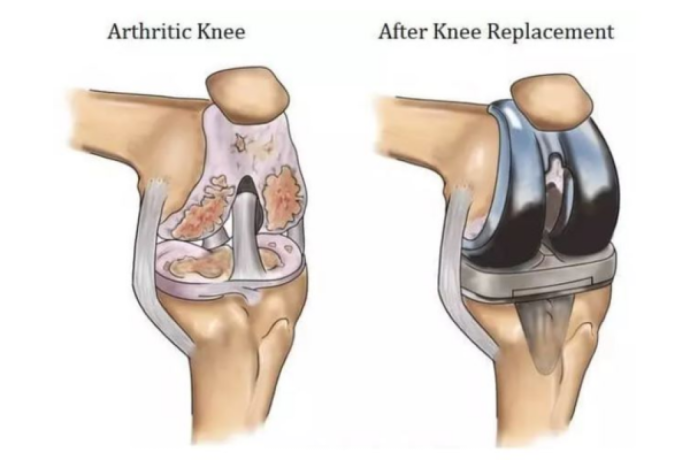 find-expert-knee-replacement-surgeon-in-delhi-delhi-ortho-clinic-big-0