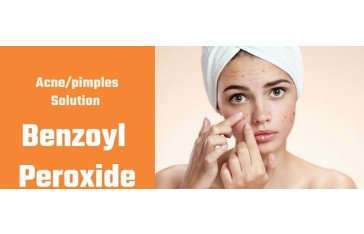 Achieve A Flawless Complexion By Using Benzaclin For Acne Treatment